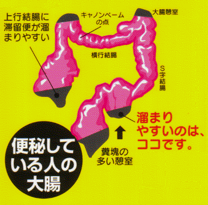 咰